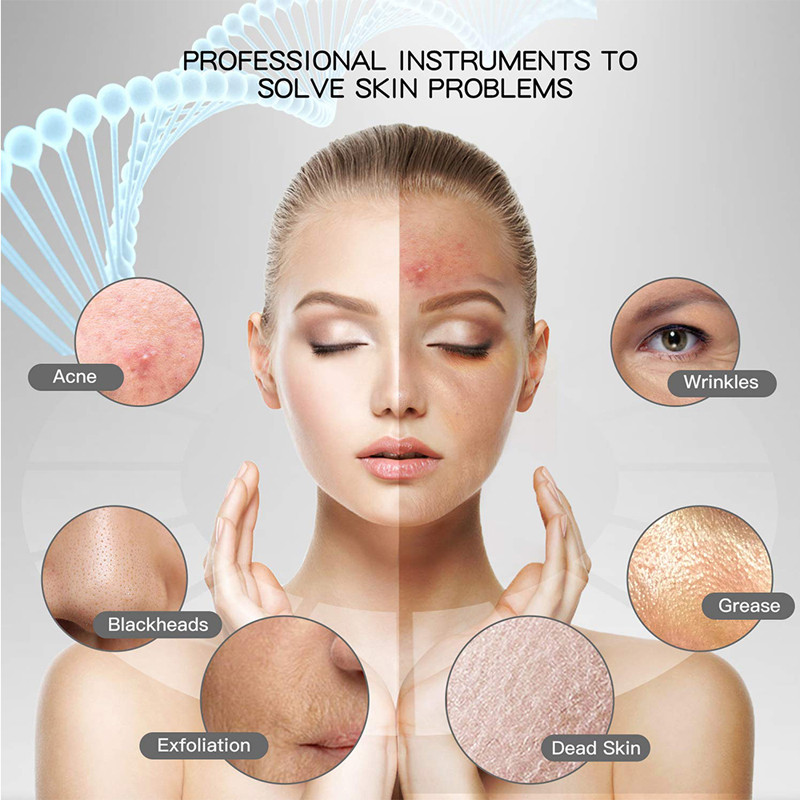 Ultrahangos bőrradír mély arctisztító gép mitesszer eltávolító peeling lapát vibráció pórustiszta arc lifting