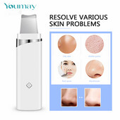 Youmay ultrahangos bőrradír mély arctisztító gép vibráló peeling lapát Mitesszer eltávolító arcradír emelő eszköz