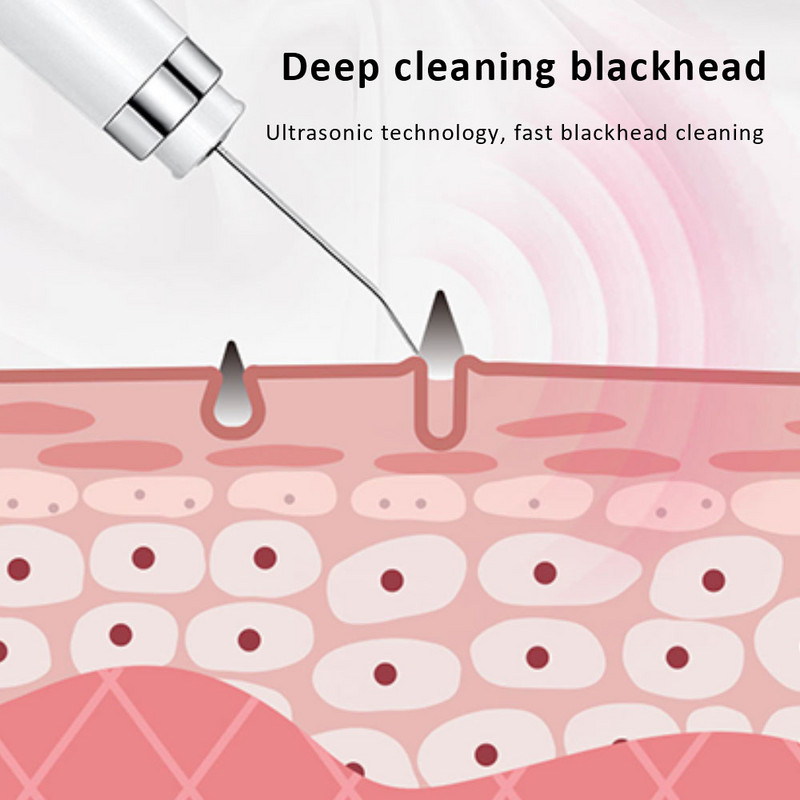 Új Ultrahangos Shovel Beauty Device Skin Scrubber Arcmasszázs Elektromos Tisztító Pórus EMS Mikroáram Beauty Tools