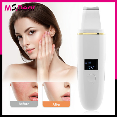 Ms.Dear Dear Ultrasonic Skin Scrubber Καθαριστικό Πόρων Deep Face Lifting Συσκευή φτυαριού Red Blue Light Remover Blackhead Skin Care Tool