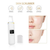 Ultrahangos bőrradír mélypórustisztító készülék peeling lapát Arcradír Ultrahangos ionos bőrtisztító mitesszer