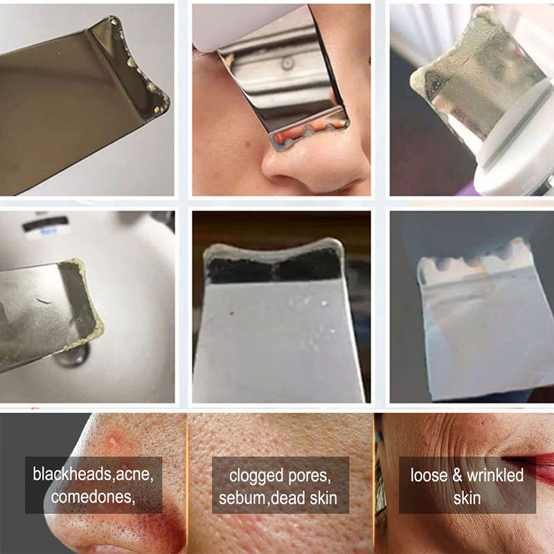 Hordozható USB-tölthető ultrahangos bőrradír spatula mitesszer eltávolító pórustisztító arckaparó Comedone pattanásos kihúzó