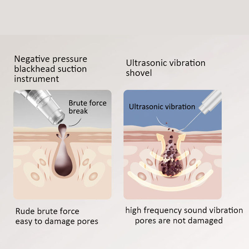 Ultrahangos bőrradír mély arctisztító gép EMS ionos vibrációs masszírozó peeling lapát arc pórustisztító kozmetikai készülék