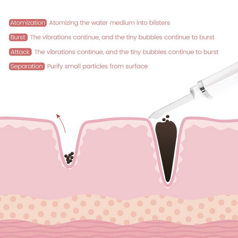 Καθαριστικό προσώπου Peeling Shovel Ion Ultrasonic Skin Scrubber Remover για μαύρα στίγματα Facial Lifting Vibration Massager Περιποίηση δέρματος