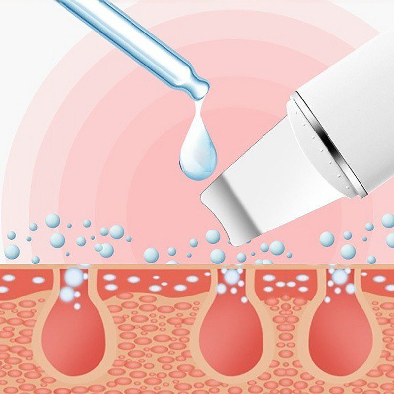 Bőrradír Ultrahangos Tisztító Arcápoló eszköz Pórus pattanás eltávolító Peeling Lapát Spatula Masszírozó Arcszépítő eszköz