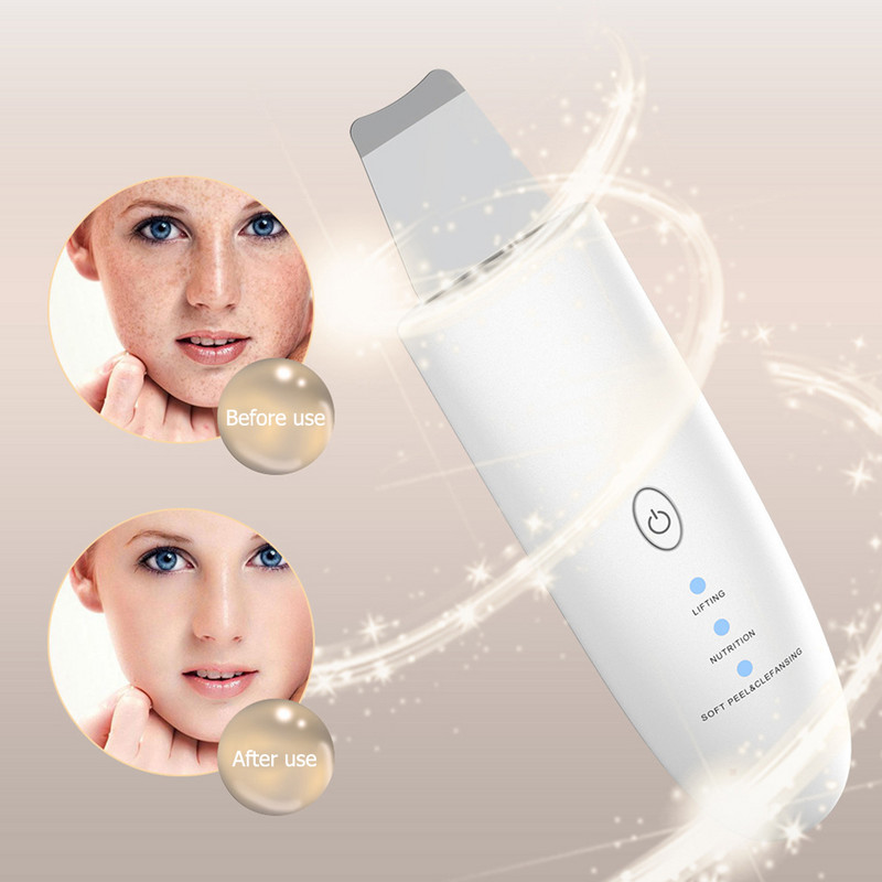 Tisztító mitesszer peeling lapát arc pórustisztító ultrahangos bőrradír Clean hámlasztó műszeres folttisztító