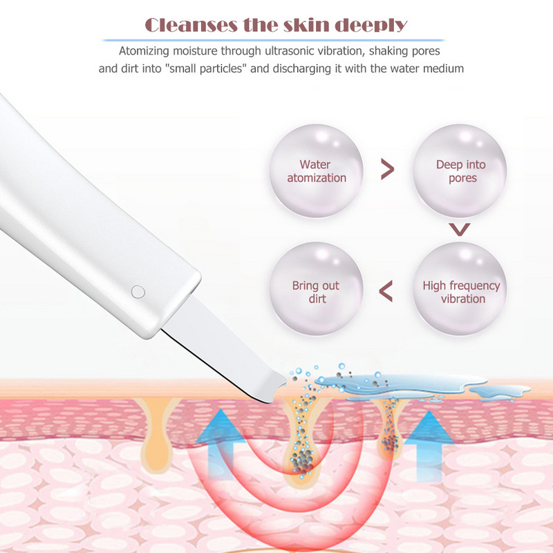 Tisztító mitesszer peeling lapát arc pórustisztító ultrahangos bőrradír Clean hámlasztó műszeres folttisztító