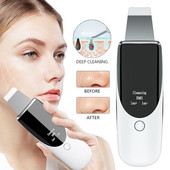 Ultrazvučni čistač kože lica Sredstvo za čišćenje protiv bora Uklanjanje mitesera Uređaj za uljepšavanje vrata Masažer za lice Alati za njegu kože