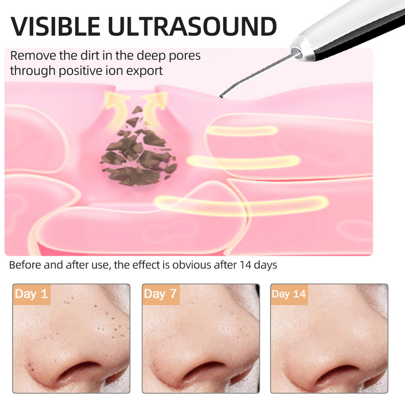 Ultrazvučni čistač kože lica Sredstvo za čišćenje protiv bora Uklanjanje mitesera Uređaj za uljepšavanje vrata Masažer za lice Alati za njegu kože