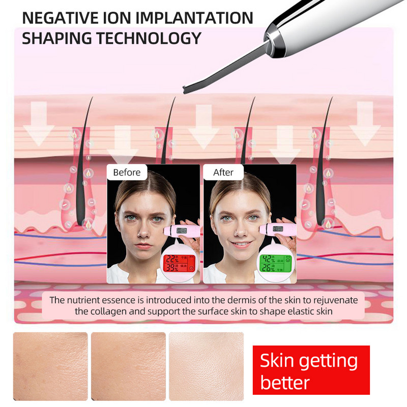 Ultrazvučni čistač kože lica Sredstvo za čišćenje protiv bora Uklanjanje mitesera Uređaj za uljepšavanje vrata Masažer za lice Alati za njegu kože