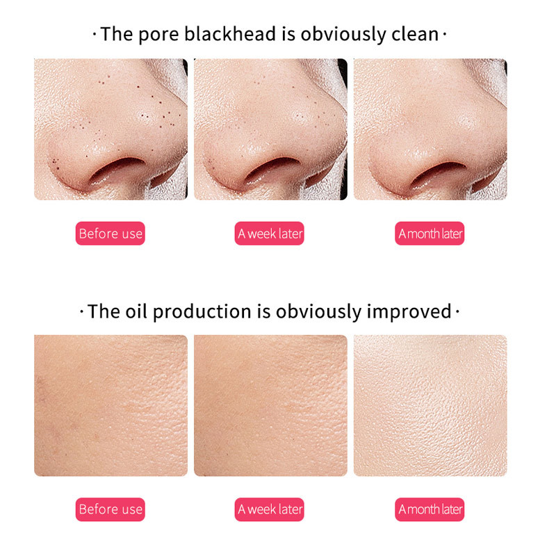 Alati za ultrazvučno ribanje kože Beauty Instrument Deep Face Sredstvo za čišćenje lica Vibrirajuća lopatica Uređaj za piling Njega kože