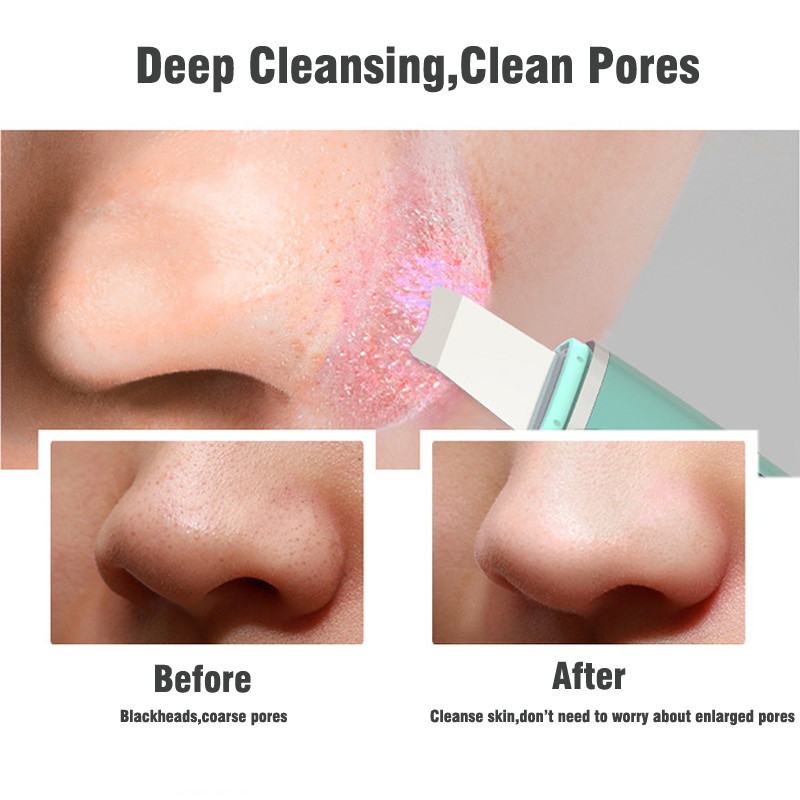 Skin scrubber Ultrahangos arc spatula arctisztító lifting akne mitesszer eltávolító szépségtisztító kefe Nano arc gőzölő