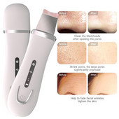 Youmay Skin Scrubber Arctisztító Bőrhámlasztó Ultrahangos Arctisztító Mitesszer eltávolító Pórustisztító Arcradír masszírozó
