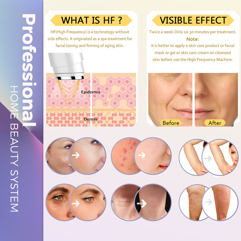 ShinSense Rádiófrekvenciás Arc Test Bőrfeszesítő RF Arc Nyak Anti Aging Lifting Tonizáló Ránctalanítás Otthoni Beauty készülék