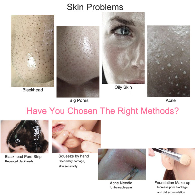 Ultrahangos bőrradír mély arctisztító gép peeling lapát arc pórustisztító arc spatula bőrradír lifting gép
