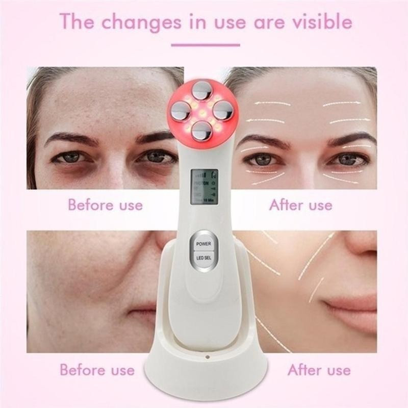 Mezoterapija elektroporacija RF radijo dažnio LED fotonų veido pakėlimas stangrinantis pašalinimas senėjimą stabdantis veido odos priežiūra