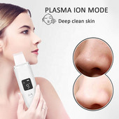 Ultrahangos vibrációs mitesszer eltávolító mélytisztító arcbőrradír pórustisztító lifting gép arcra Led peeling lapát