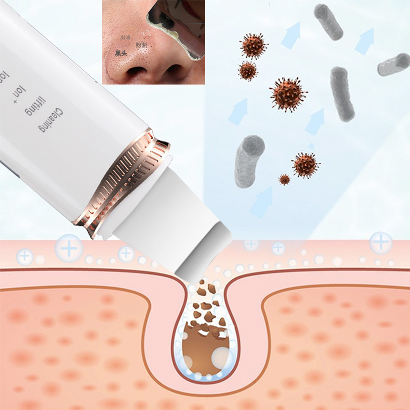 Peeling Lapát tisztító Ultrahangos bőrradír mitesszer akne mérő Ultrahangos peeling lapát tisztító arckaparó EMS Lifter