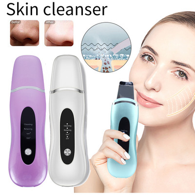 Ultraskaņas izsmidzināšanas ādas skruberis Vibrācijas sejas lāpstiņa Melngalvju pūtīšu noņemšanas līdzeklis Dead Skin Care Clean sejas skrubera lāpsta