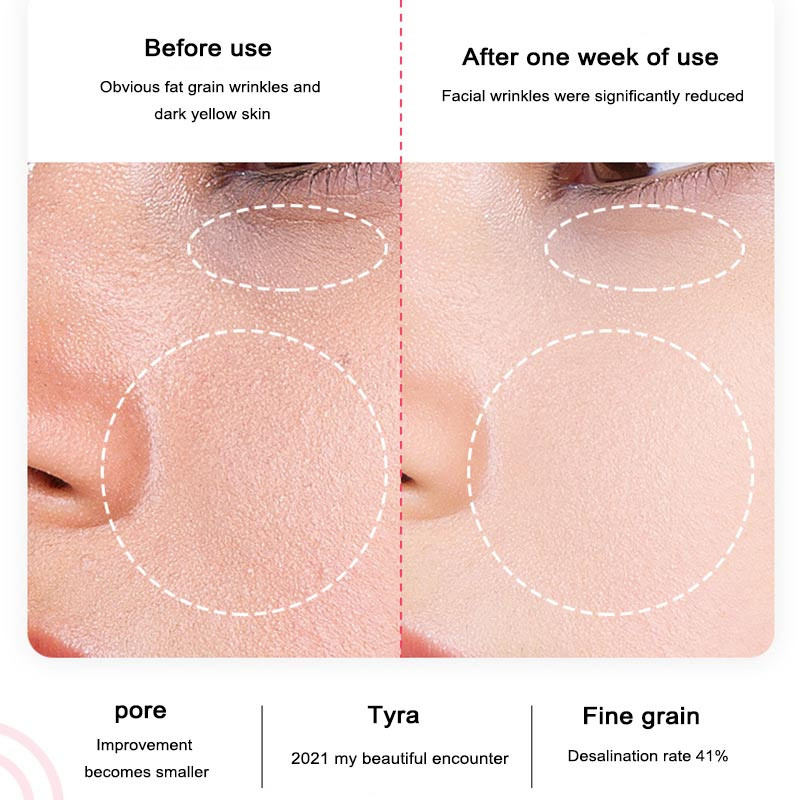 Kuum ja külm iontoforees näoilu ioon noorendamine puhastus puhastus majapidamises iluinstrument