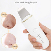 Ultrahangos bőrradír vibrációs arc spatula mitesszer eltávolító arcradír lapát Tiszta kavitációs peeling arc lifting