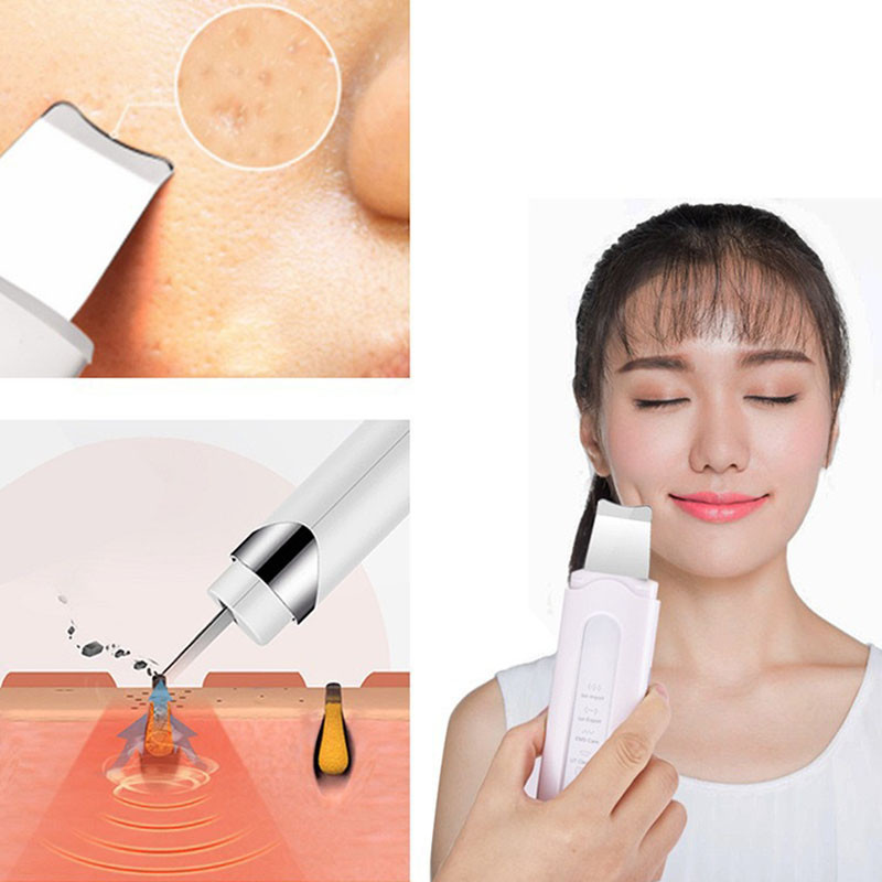 Šveitimo kastuvas Odos šveitiklis vibruojantis veido mentele inkštirų valiklis veido valymui gilias poras kavitacijos pilingas odos priežiūros įrankis