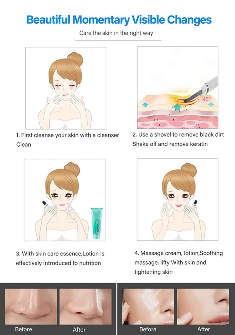 Ultrahangos bőrradír Beauty Tools Arctisztító Mitesszer eltávolító Arcradír Lapát Tiszta Kavitációs Peeling Bőrápolás