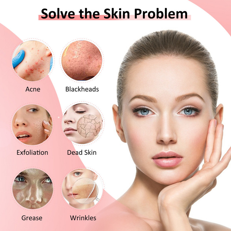 Ultrazvučna lopatica za ribanje kože Ultrazvučni ionski aparat za dubinsko čišćenje lica Vibrator za uklanjanje mitisera Vibrator za čišćenje lica od bora