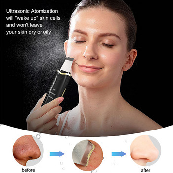 Уред за почистване на лице Ултразвуков скрубер за кожа Пилинг Премахване на черни точки Вибратор Лифтинг на лицето EMS Светлинна терапия Машина за почистване на порите на лицето