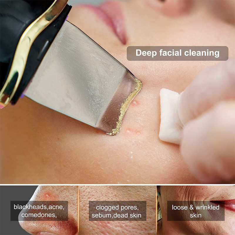 Arctisztító Ultrahangos Bőrradír Peeling Mitesszer eltávolító Vibrátor Face Lift EMS Fényterápiás Arcpórustisztító Gép