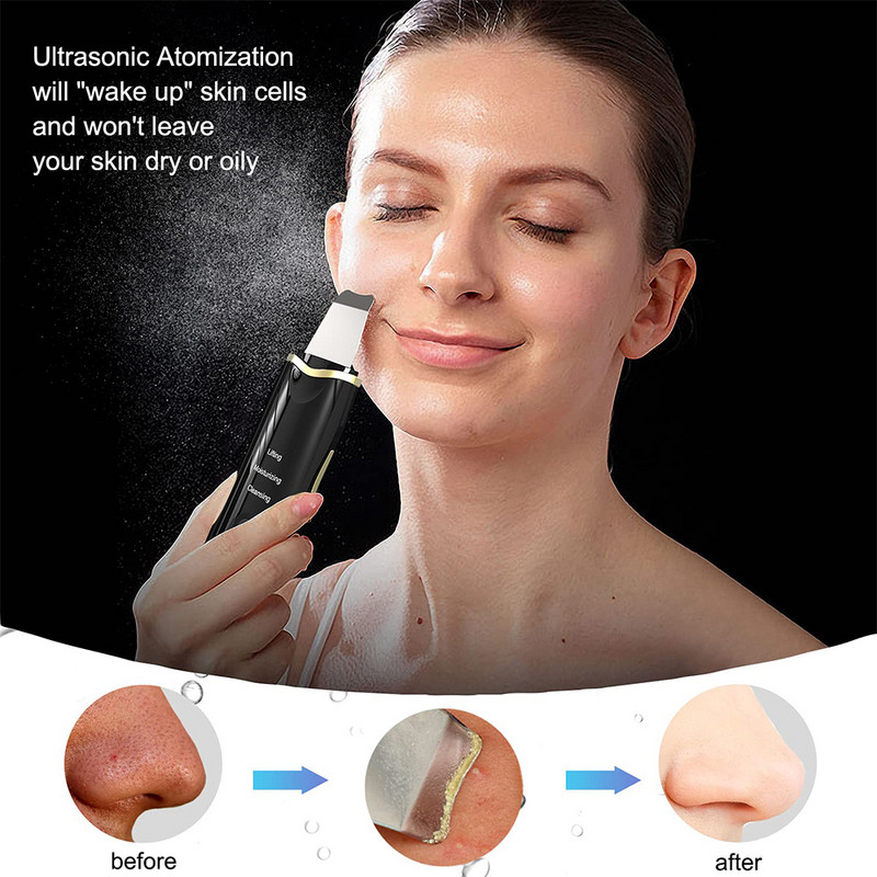 Arctisztító Ultrahangos Bőrradír Peeling Mitesszer eltávolító Vibrátor Face Lift EMS Fényterápiás Arcpórustisztító Gép