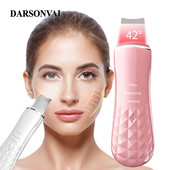 42℃ Fűtés Ultrahangos arcbőrradír Állandó hőmérsékletű Ion Arc Mélytisztító Peeling Lapát Hámlasztó Bőrápoló