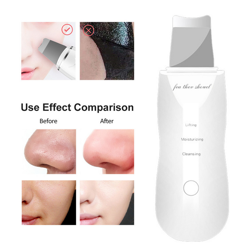Arcradíros peeling arcmasszírozó vibrációs akne mitesszer eltávolító bőrtisztító + nano arcpermetező gőzpárásító