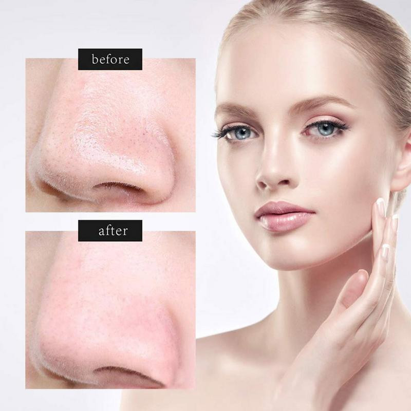 Skin scrubber spatula arcbőrradír spatula mitesszer eltávolító tisztító vízálló USB töltő az arc mély tisztításához