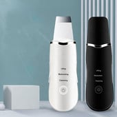 Ultrahangos Bőrradír Vibrációs Arc Spatula Mitesszer eltávolító Lapát Tiszta Kavitációs Peeling Arc Lifting Bőrápolás