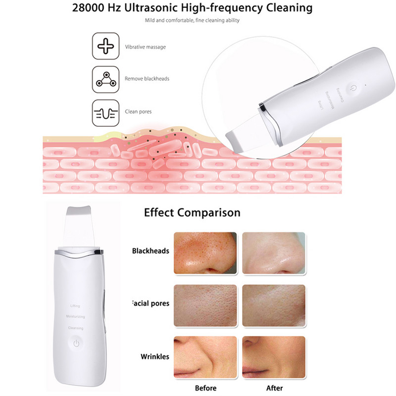 Ultrahangos bőrradír Bőr Ultrahangos Tisztító Peeling Extractor Arclifting Hámlasztó Mélytisztító Beauty Apparátus