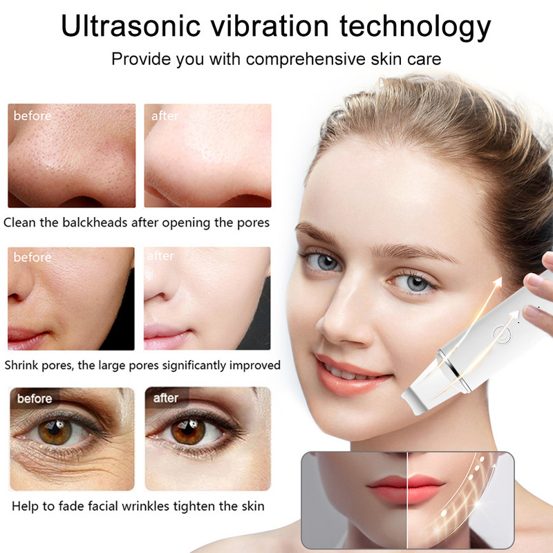 Ultrahangos arcbőrradír vibrációs orr spatula mitesszer eltávolító súroló lapát Tiszta kavitációs peeling arc lifting