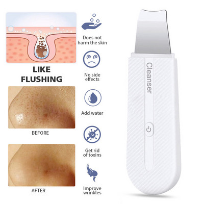 Ultrahangos bőrradír Ion mély arctisztító mitesszer eltávolító arclapát bőrkaparó arc spatula ultrahangos peeling