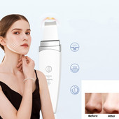 Ultrahangos bőrradír peeling mitesszer eltávolító mély arctisztító ultrahangos ionos ance pórustisztító arclapátos arctisztító