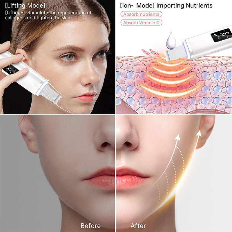 Ultrahangos bőrápoló súroló spatula arcmasszírozó holt bőr mitesszer eltávolítása ultrahangos arc peeling lifting eszközök