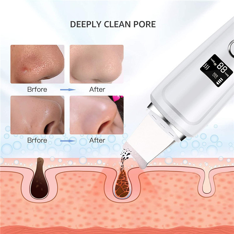 Pórustisztító Ultrahangos Bőrradír Arc Spatula Mitesszer eltávolító Mély Arctisztító Lift Gép peeling Lapát