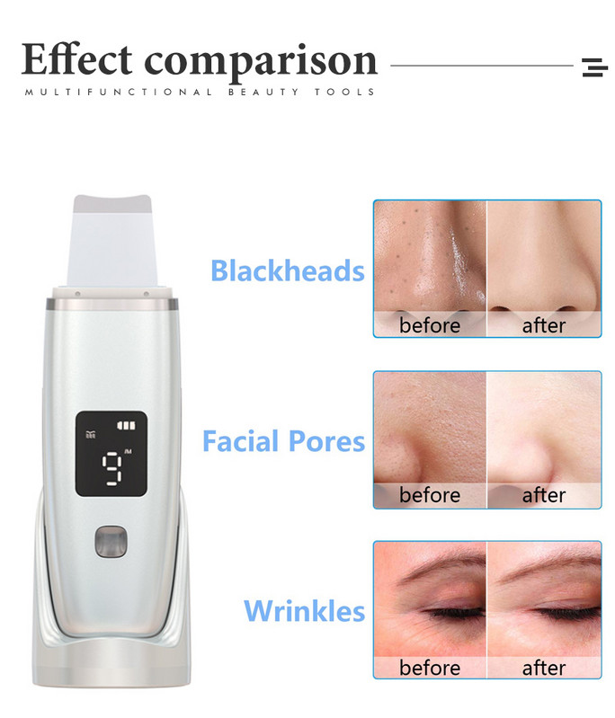 Ultrahangos bőrradír mély arctisztító gép peeling lapát arc pórustisztító arcbőrradír lift lift gép szépség