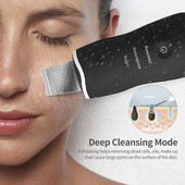 Ultrahangos bőrradír mély arctisztító gép peeling lapát arc pórustisztító arcbőrradír lift lift gép szépség