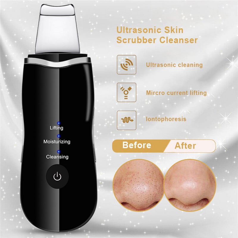 Ultrahangos bőrradír mély arctisztító gép peeling lapát arc pórustisztító arcbőrradír lift lift gép szépség