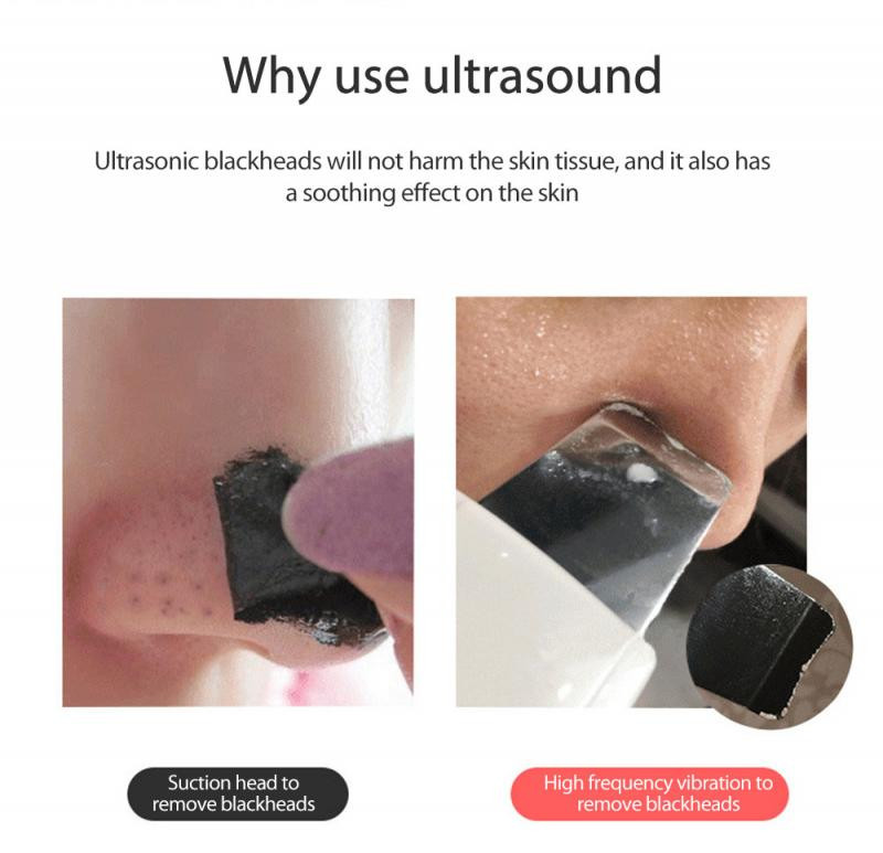 Ultrahangos arctisztító bőrradír arctisztító bőrradír mitesszer eltávolító pórustisztító USB arctisztító eszköz