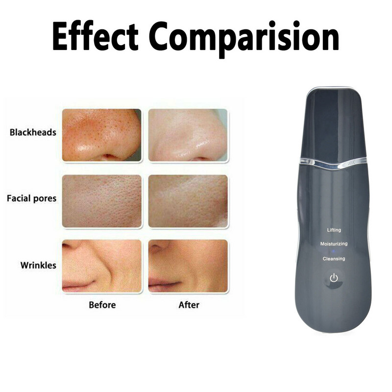 Ultrazvučni stroj za dubinsko čišćenje lica Čistač kože Čistač za uklanjanje mrtve kože Odstranjivanje prljavštine Miteseri Smanjenje bora Mrlje Njega lica