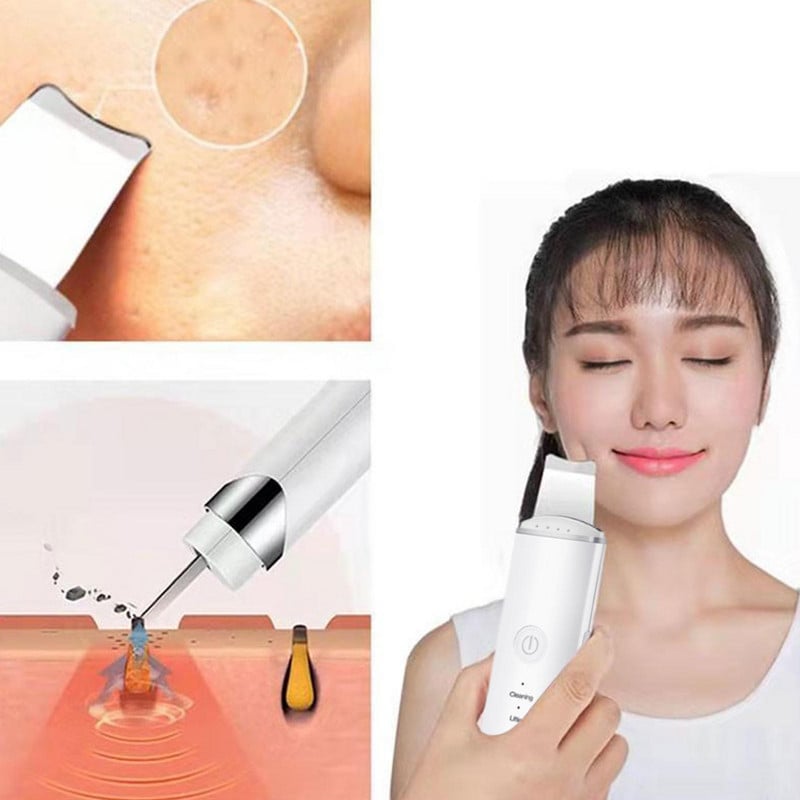Ultrahangos bőrradír vibrációs arc spatula mitesszer eltávolító arcradír lapát Tiszta kavitációs peeling arc lifting