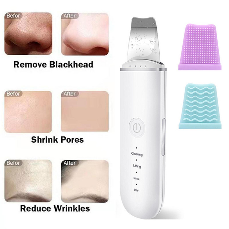 Ultrahangos bőrradír vibrációs arc spatula mitesszer eltávolító arcradír lapát Tiszta kavitációs peeling arc lifting