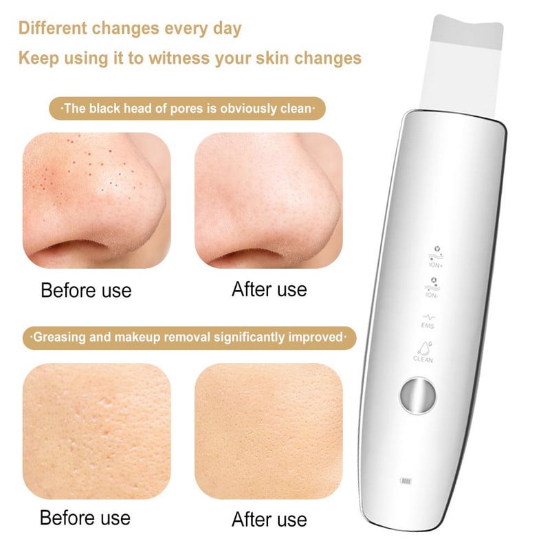 Ultrahangos arcradír Beauty Red&Blue Light LED Photon Therapy EMS Facial Peeling Ion Pore Clean Távolítsa el a mitesszer hámlást