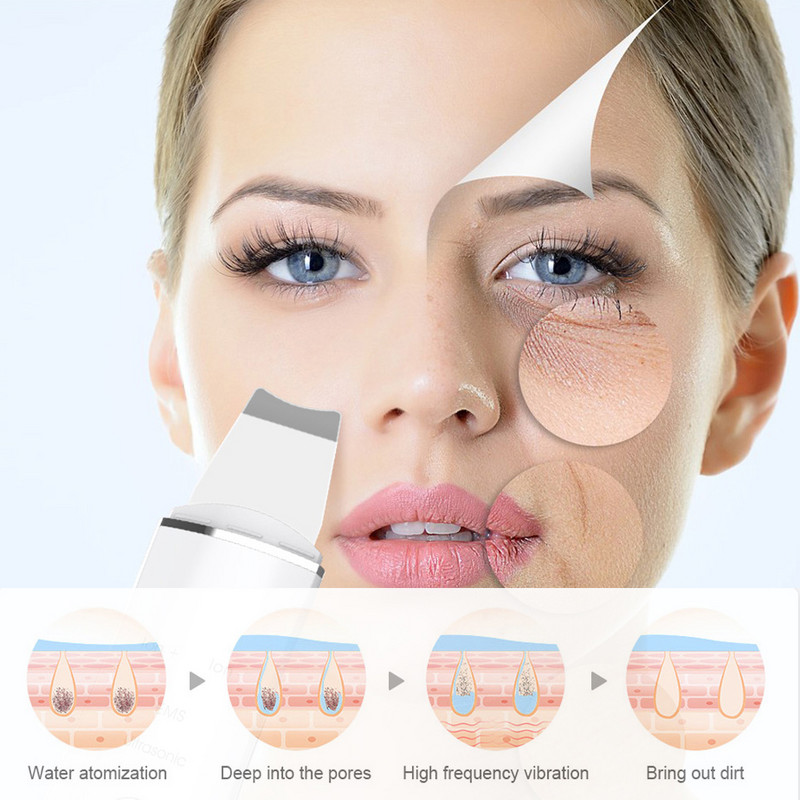 Újratölthető ultrahangos arcbőrradír mély arctisztító gép peeling lapát Arc pórustisztító arcbőrradír eszköz